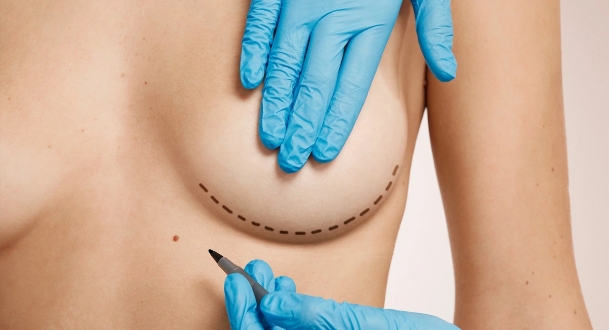 cirurgia-de-mama-quando-procurar-orientacao-especializada